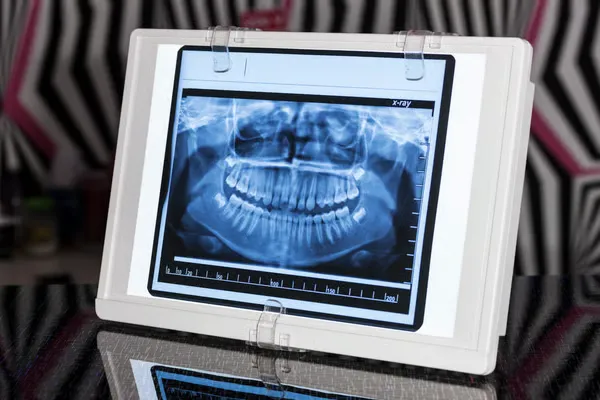 Badanie stawów skroniowo-żuchwowych