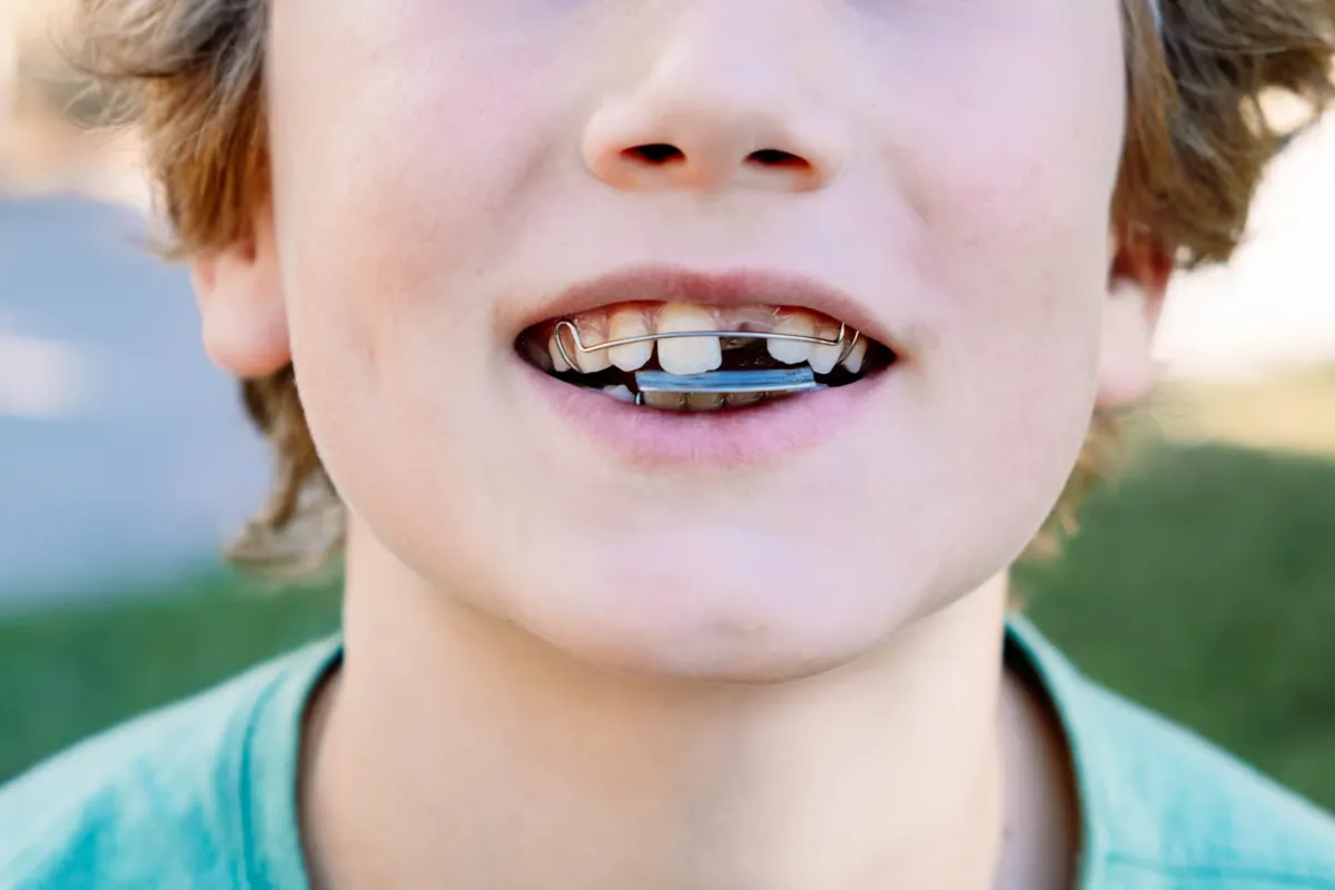 Ortodoncja – przegląd usług