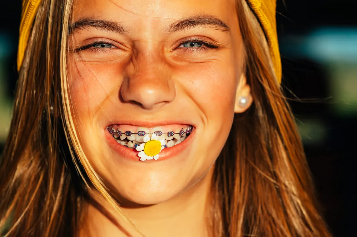 Aparaty ortodontyczne dla dzieci