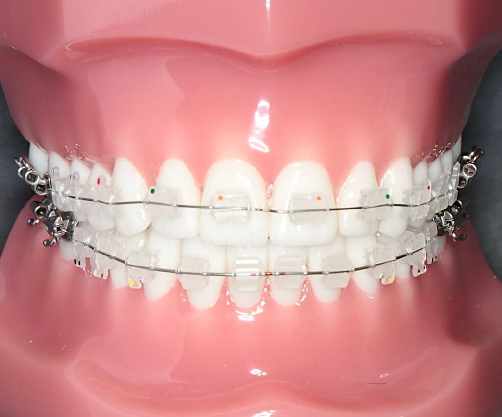 Ortodoncja Dla Doroslych