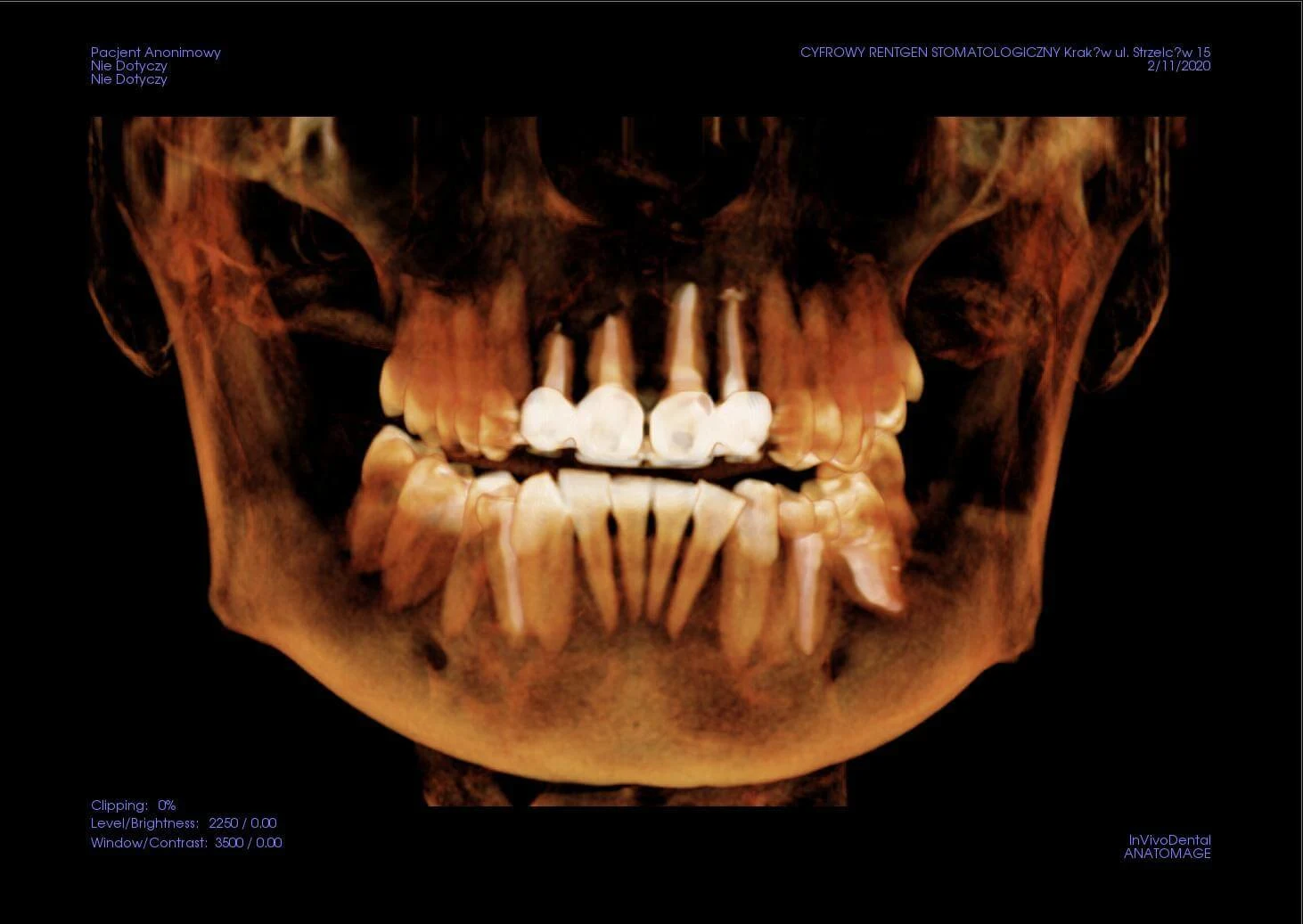 Tomografia CBCT 3D