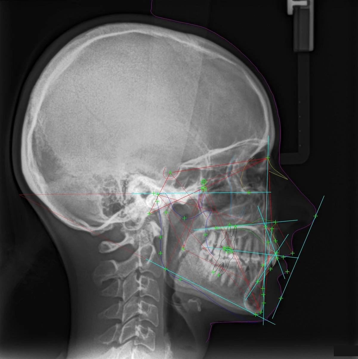 Diagnostyka ortodontyczna