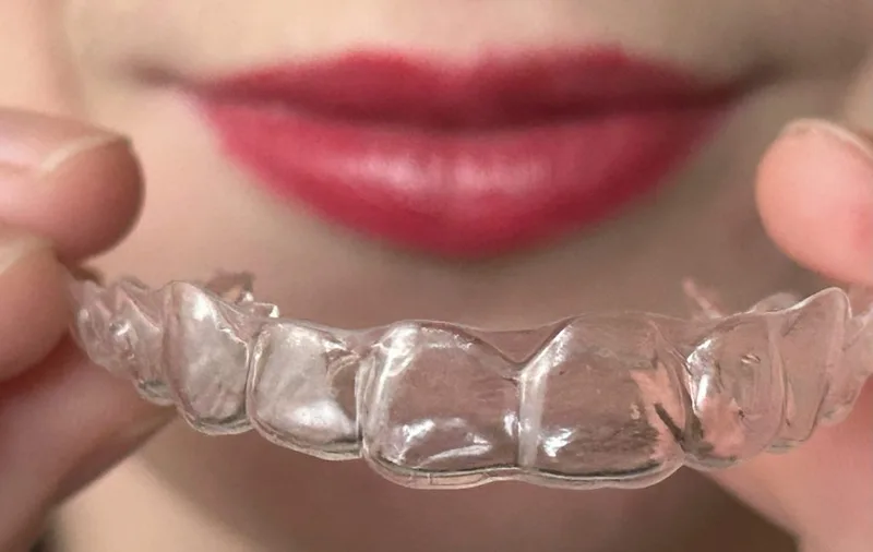 Retencja po leczeniu ortodontycznym