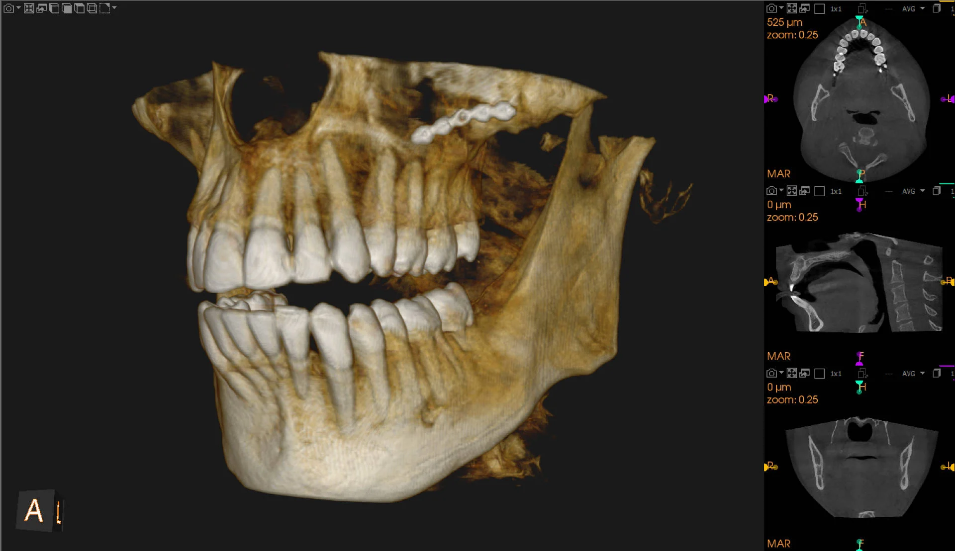 Diagnostyka ortodontyczna