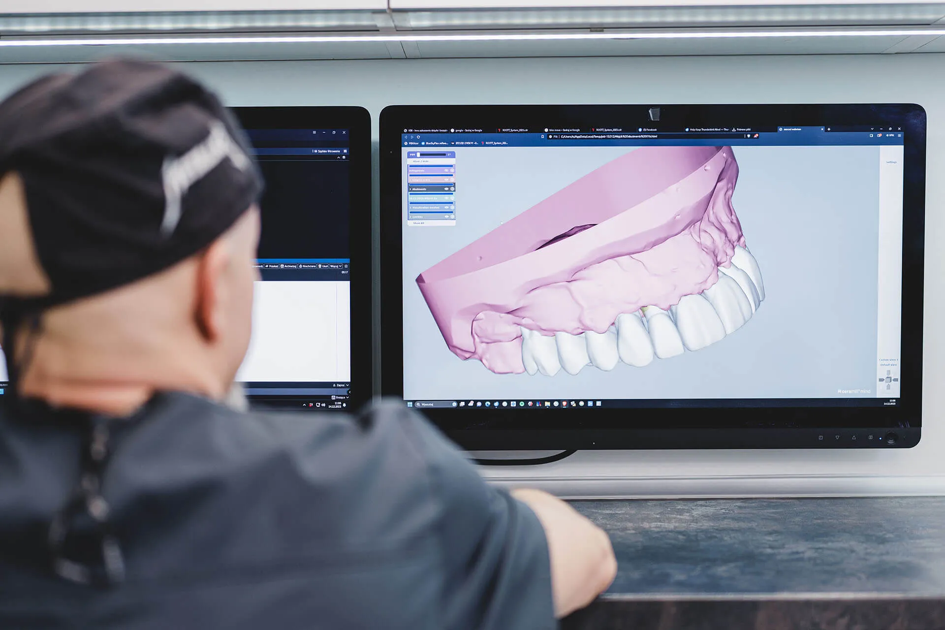 Protetyka Stomatologiczna