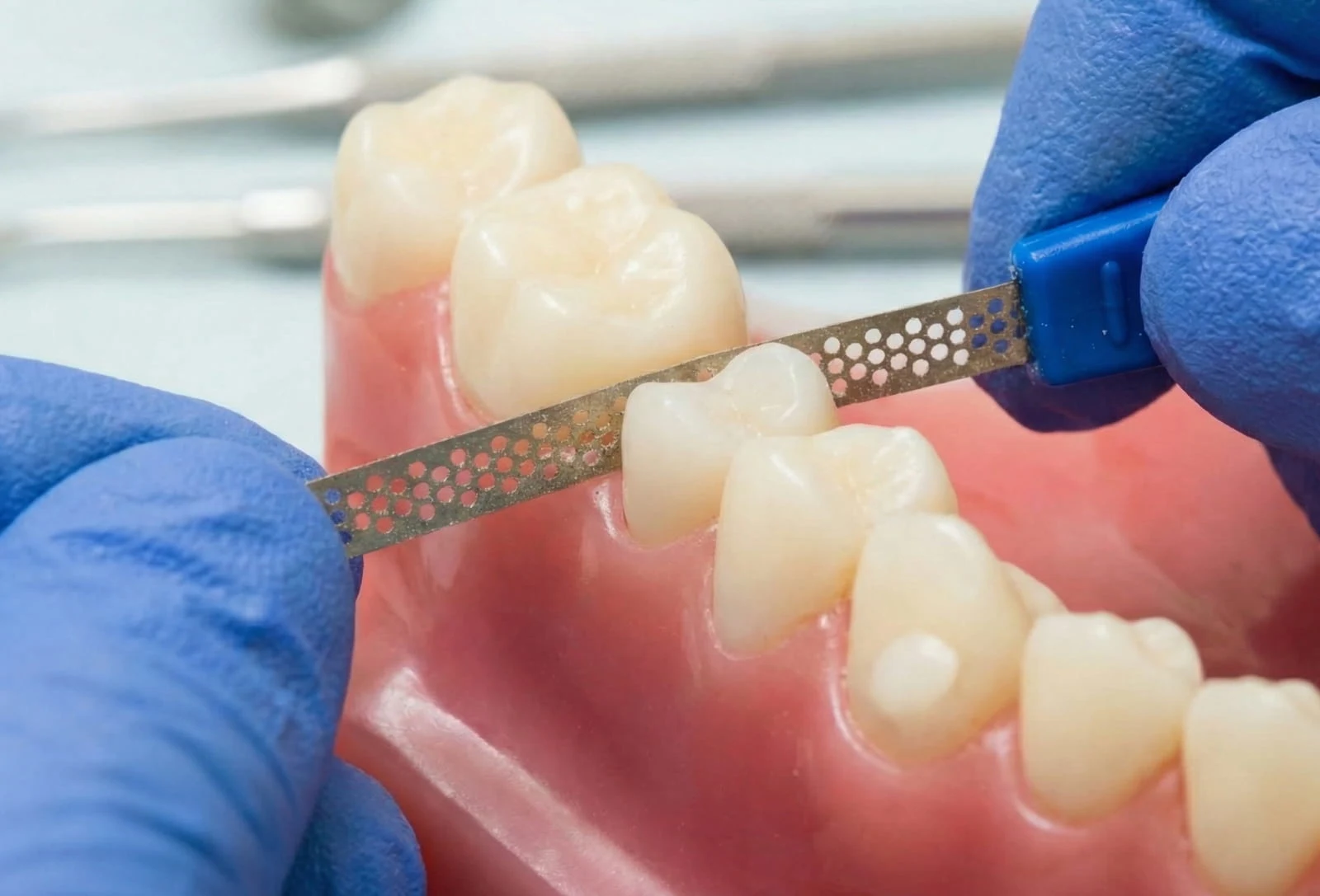 Nakładki Jak Dziala