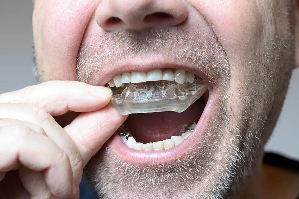 Leczenie bruksizmu i SSŻ