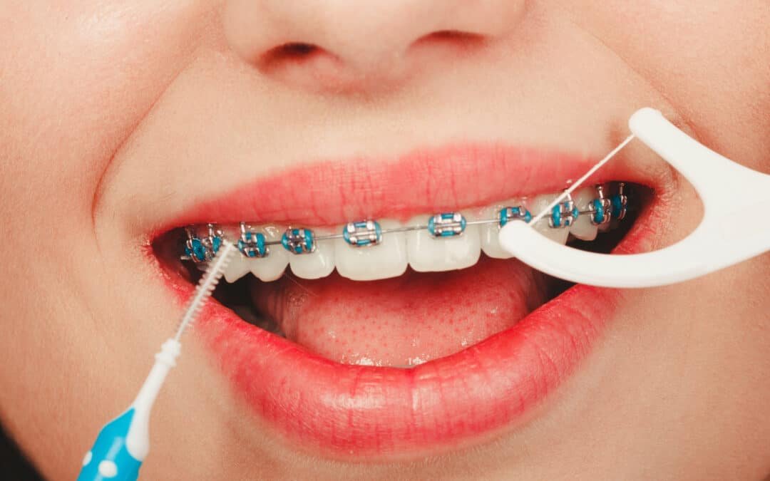 Higienizacja zębów