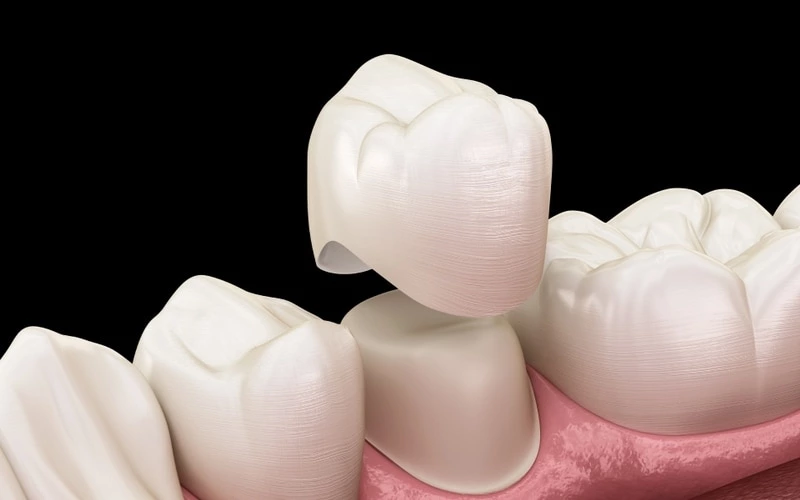 Protetyka stomatologiczna