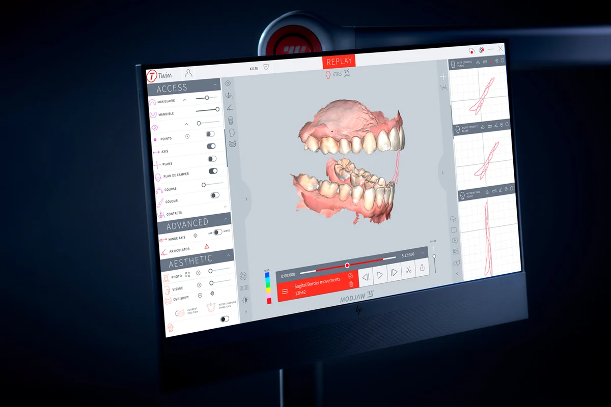 Skaner wewnątrzustny – nowoczesny sprzęt ortodontyczny