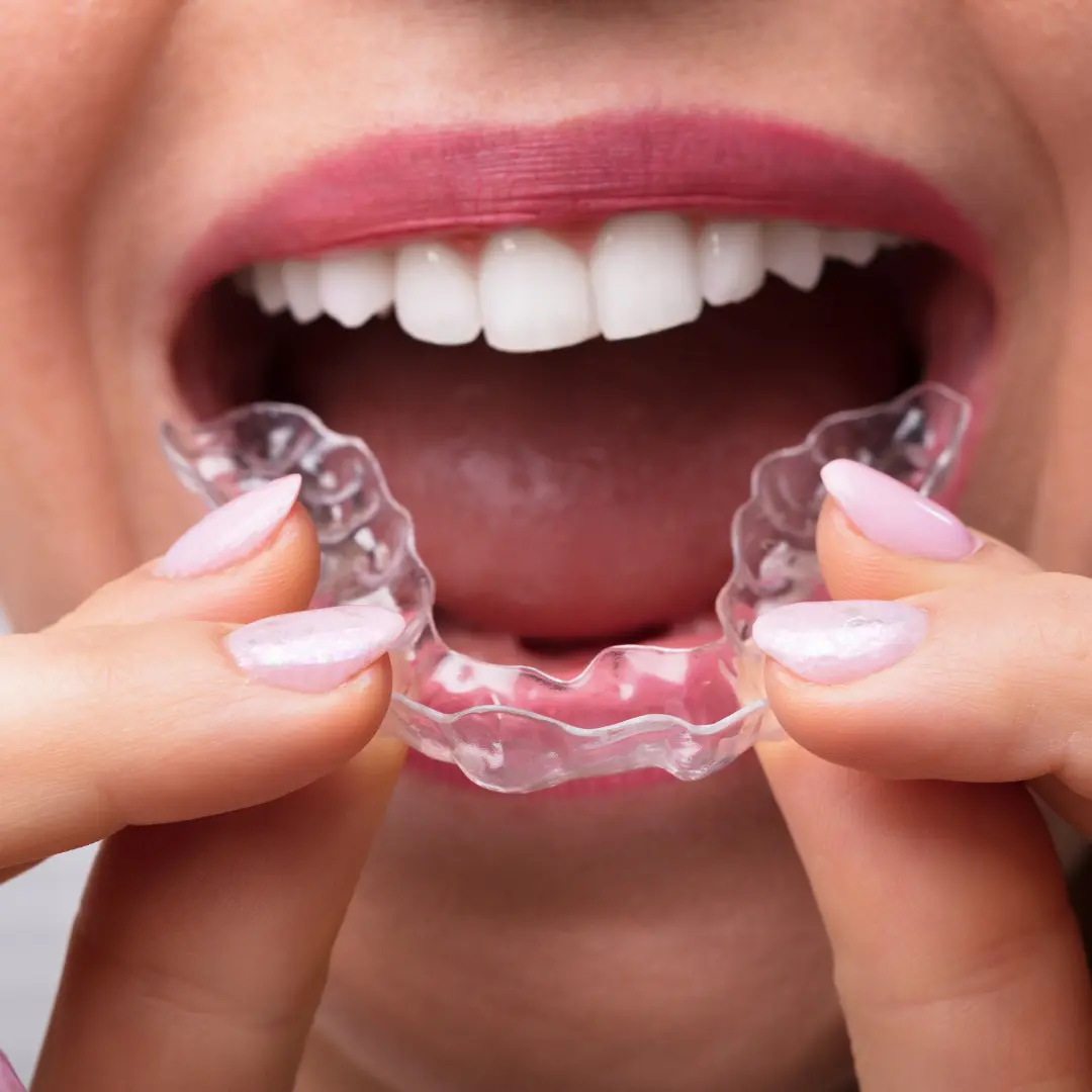 Nakładki Przebieg Leczenia