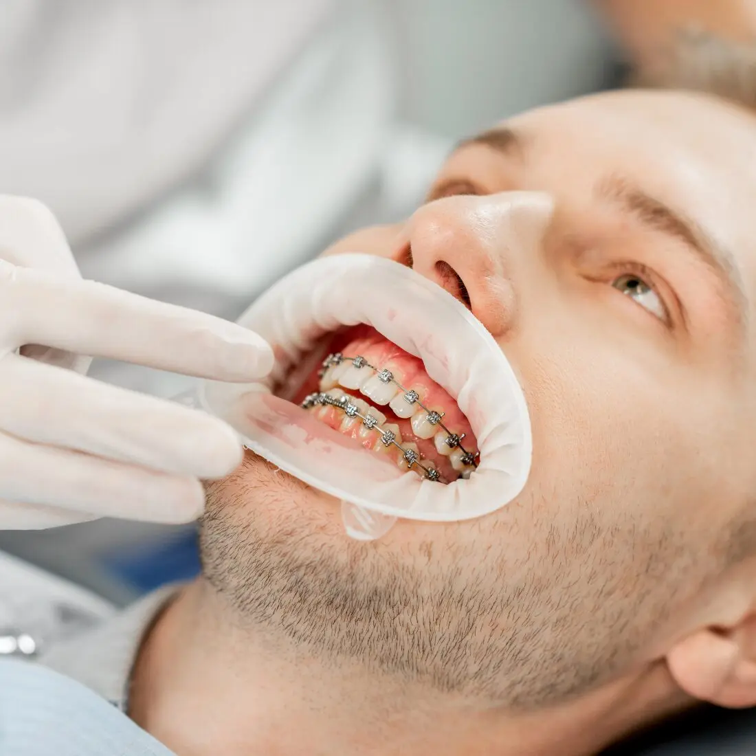 Konsultacja Ortodontyczna