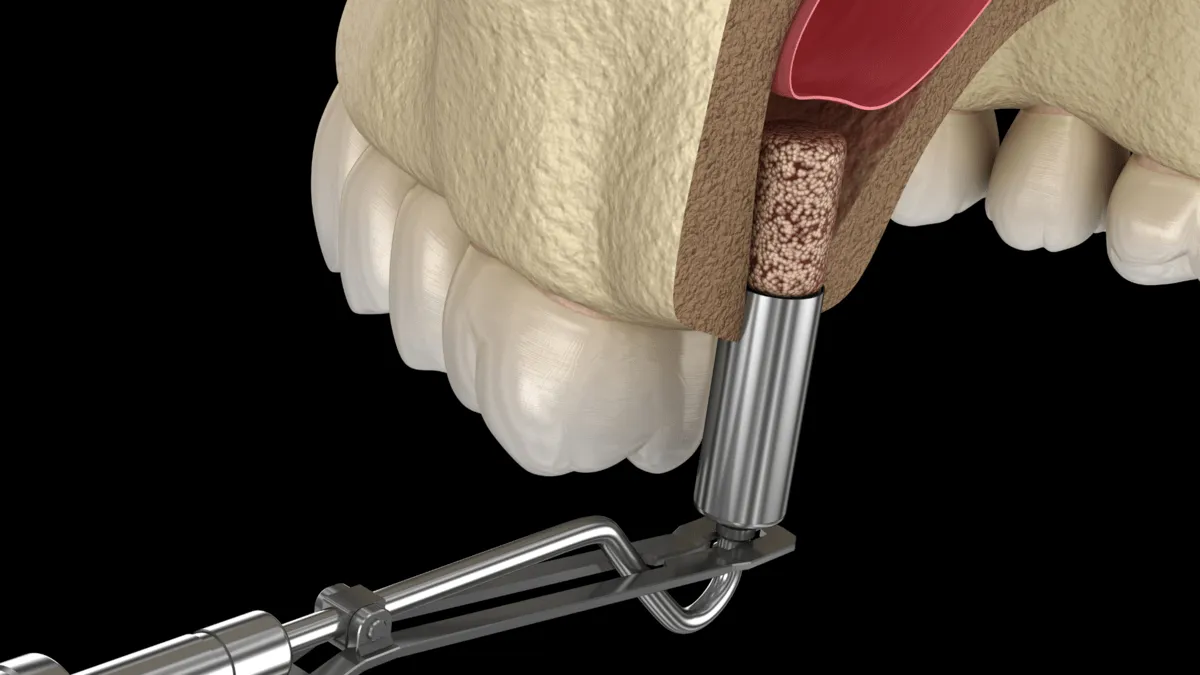 Podniesienie Dna Zatoki Szczekowej