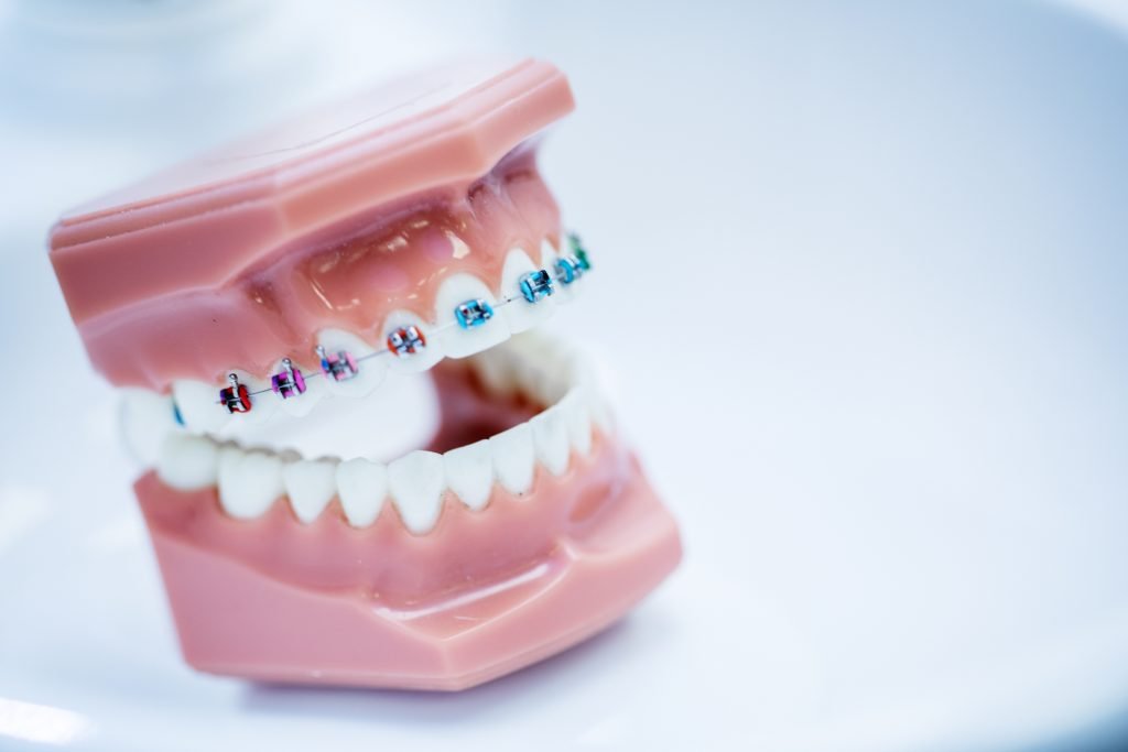 Rekonstrukcja Zgryzu