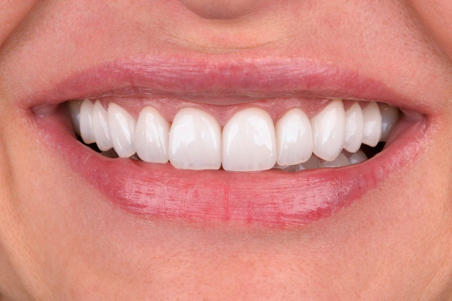 Rekonstrukcja zgryzu