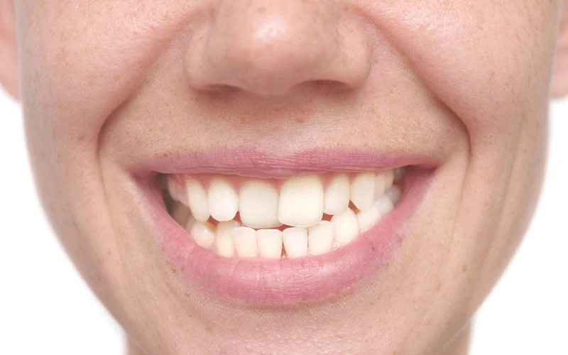 Jak Rozpoznac Wade Zgryzu