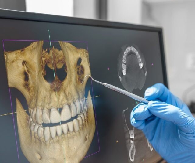 Diagnostyka ortodontyczna