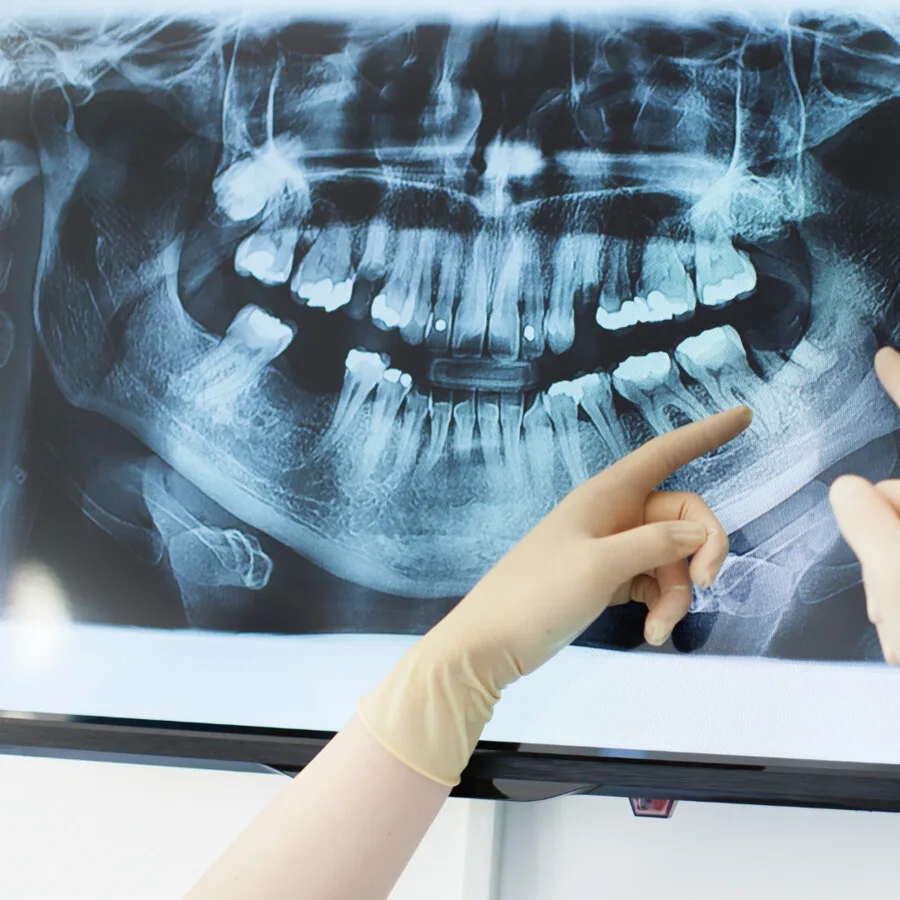 Tomografia CBCT stawów SSŻ