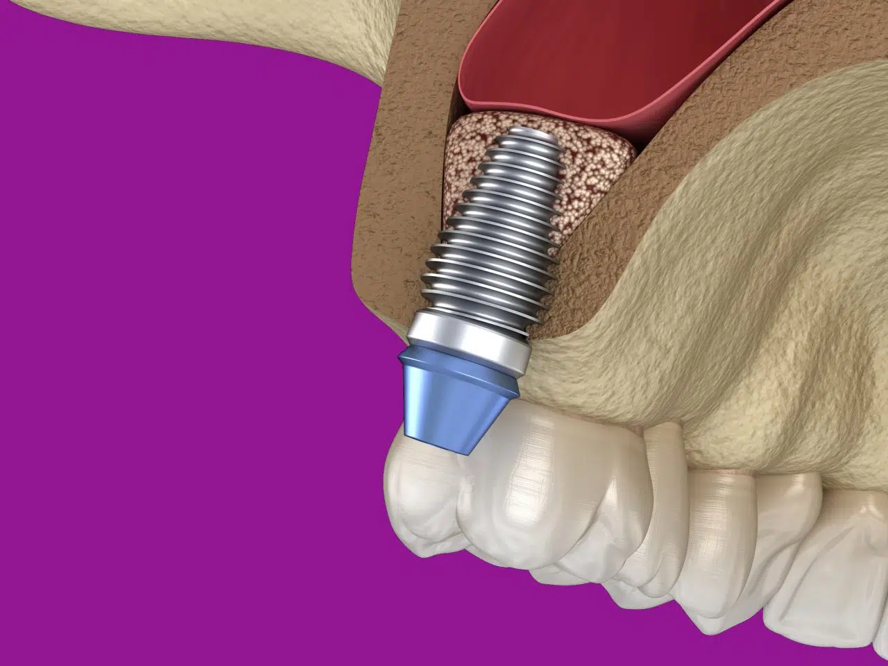 Podniesienie Dna Zatoki Szczekowej