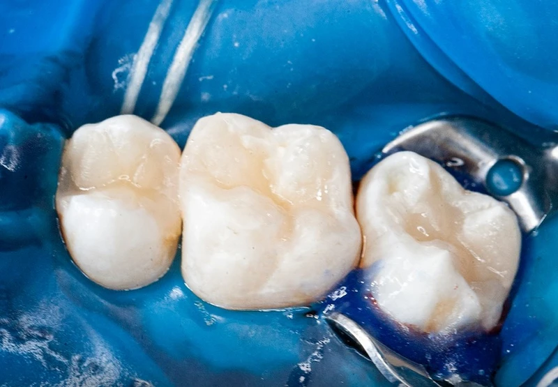 Stomatologia zachowawcza