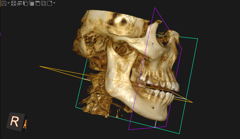 Tomografia CBCT 3D