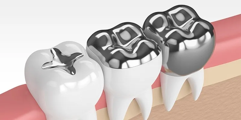 Protetyka stomatologiczna